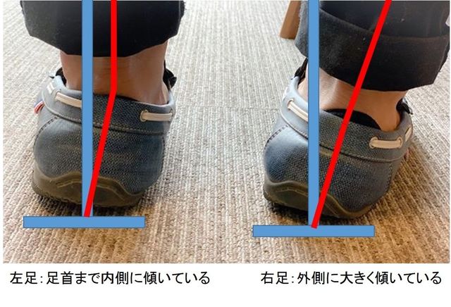 「避けた方がいい靴」の見極め方